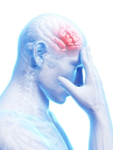 stroke brain health
